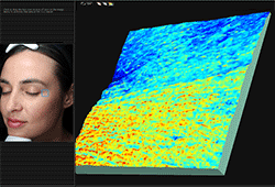 visualisation 3D de la peau Visia